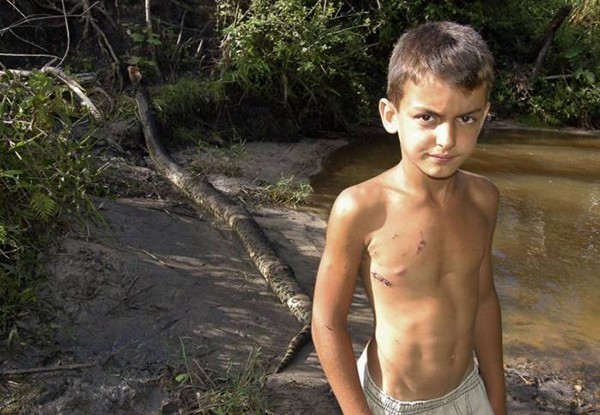 An 8-year-old boy, Matheus Pereira de Araujo, standing in front of the same 15-foot anaconda that attacked him the day before.